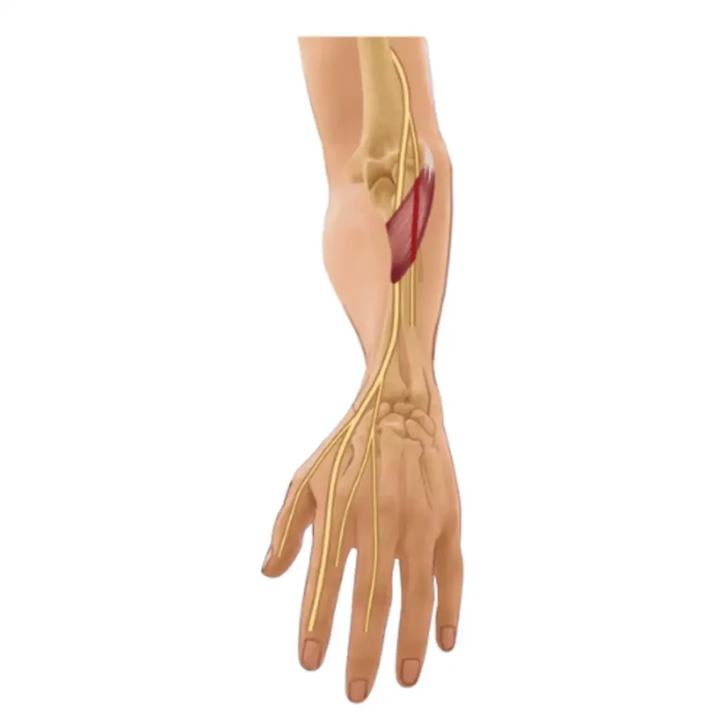 forearm nerve pain evaluated with nerve conduction study Illinois