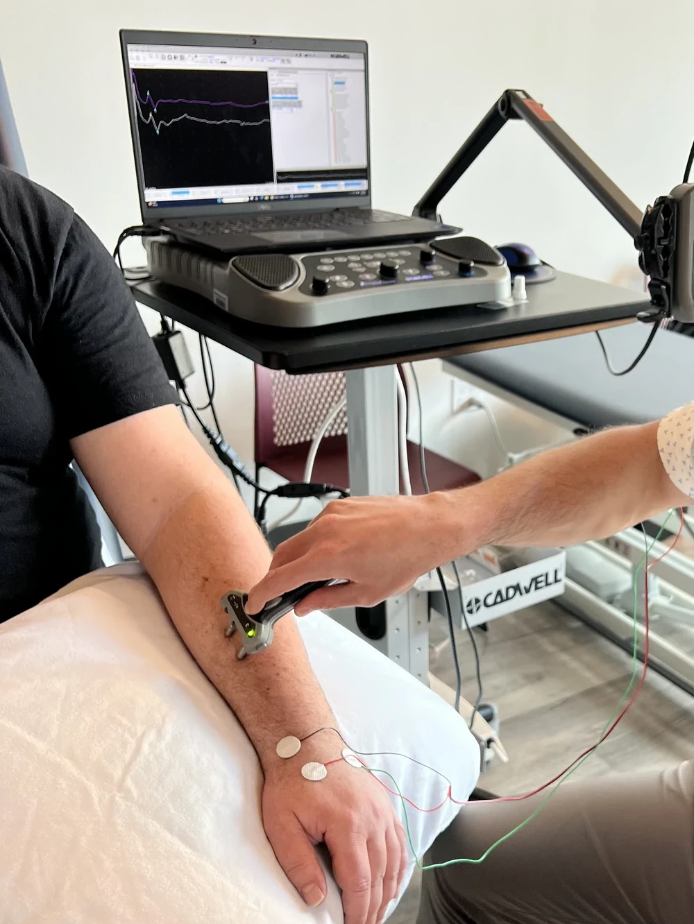 somatosensory evoked potentials test with patient and electrodes setup